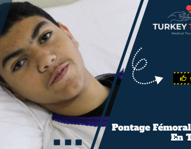 Pontage Fémoral en Turquie - Tahar d'Algérie